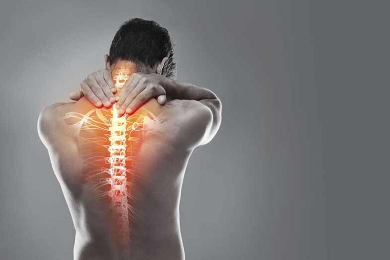 Osteochondróza krčnej oblasti