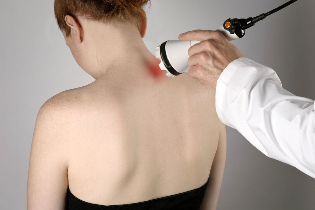 fyzioterapeutická liečba cervikálnej osteochondrózy