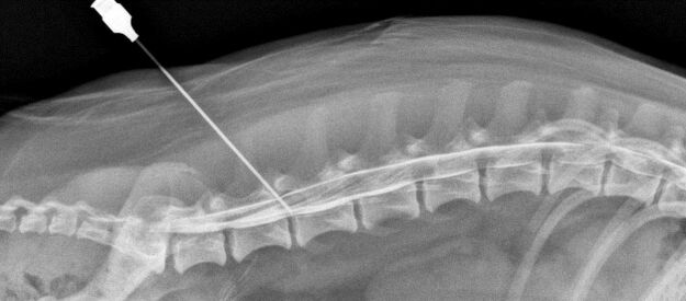 blokáda chrbtice s osteochondrózou